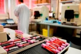 Antidopingová laboratoř ve švýcarském Lausanne.